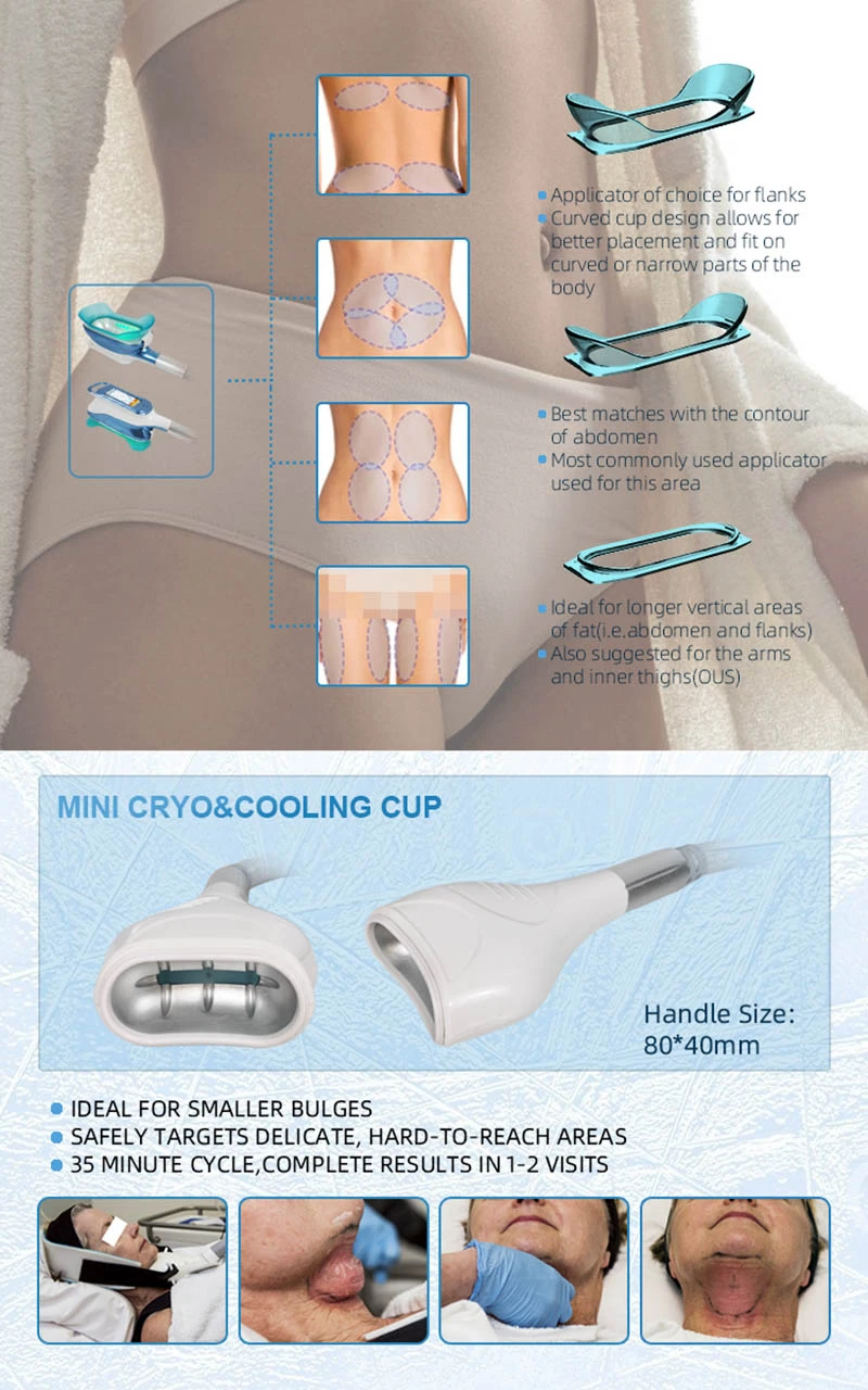 cryolipolysis 4 cryolipolysis 4