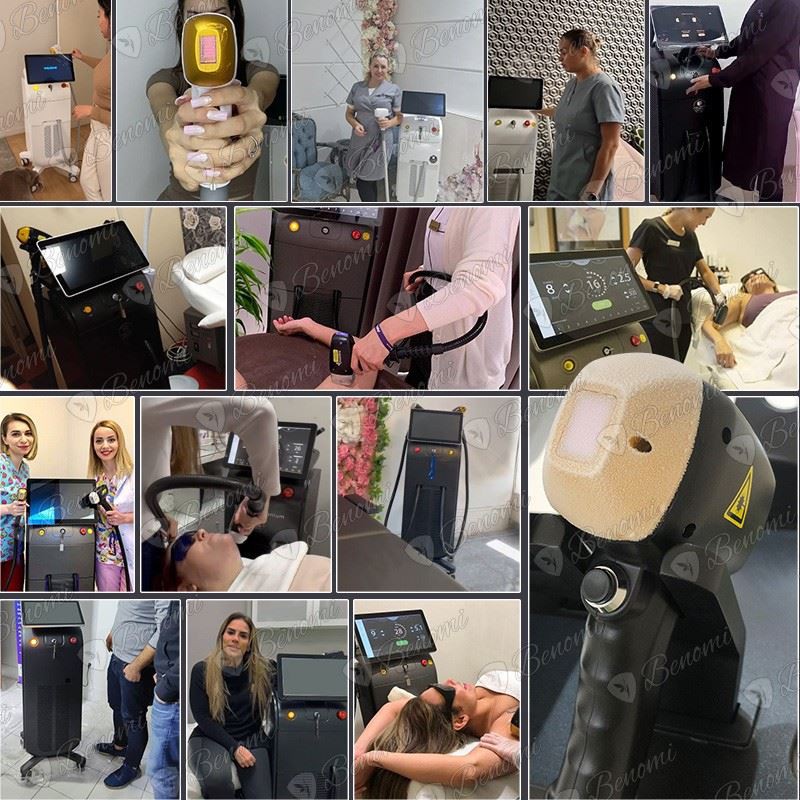 High-Performance Diode Laser Hair Removal Machine factory