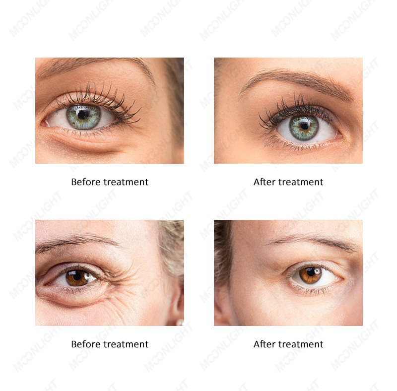 Inner Roller Ball Body & Face Sculptor factory